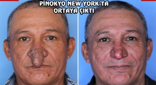 New York'ta Pinokyo Burunlu Adam...