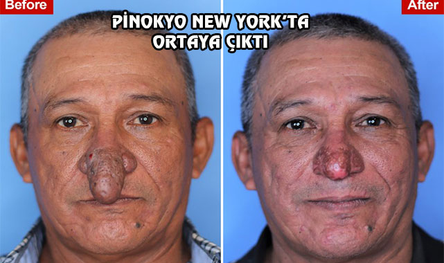 New York'ta Pinokyo Burunlu Adam...