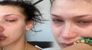 Bella Hadid: Çocukken ailenin utanç kaynağı gibi hissediyordum