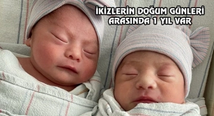Californialı İkizlerin Doğum Günleri arasında 1 Yıl Var