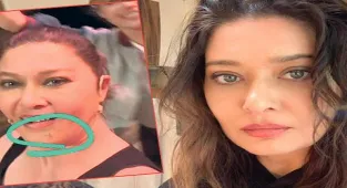 Nurgül Yeşilçay fren yerine gaza basmış!