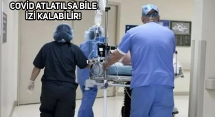 Covid Geçirenlerde 6 Ay Sonra Bu Belirtilere Dikkat!