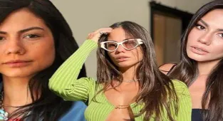 Demet Özdemir 'Botoksum bile yok' dedi! Eski fotoğrafları yeniden gündeme geldi