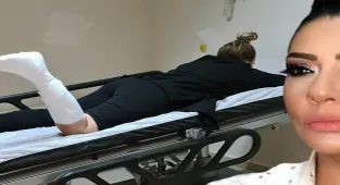Işın Karaca ayağını kırdı! 'İş kazası deyip geçme'