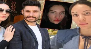Mihriban Hurmacı: Yüzümü yumruklamaya başladı, saçımdan tutup kafamı cama vurdu