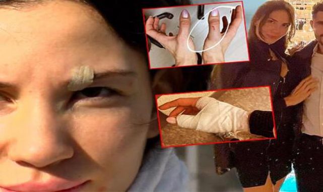 SON DAKİKA: Özer Hurmacı'dan açıklama geldi