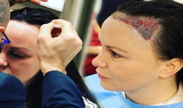 Chanelle Hayes saç ektirdi: Kendimden nefret eder hale gelmiştim!