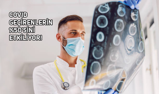 Covid Geçirenlerin Beyninde Küçülme Olabiliyor
