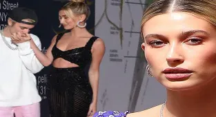 Hailey Baldwin felç belirtileri gösterdi! Apar topar hastaneye kaldırıldı