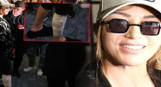 Hande Yener ödül törenine ayağı sargılı katıldı: Bacak nazarmış!