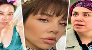 Yeşim Ceren Bozoğlu: 25'lik genç kızlar botoks yaptırıyor!