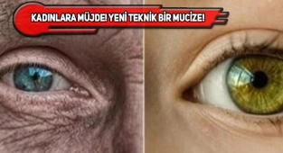 53 Yaşındaki Kadının Cildi 30 Yıl Gençleştirildi!