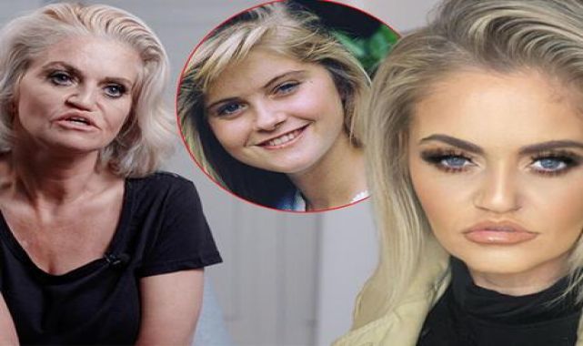Danniella Westbrook tekrar bıçak altına yatmaya hazırlanıyor