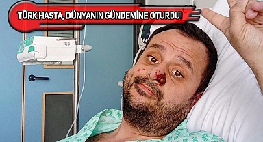 Maymun Çiçeği Bulaşan Türk, DSÖ'nün Gündeminde