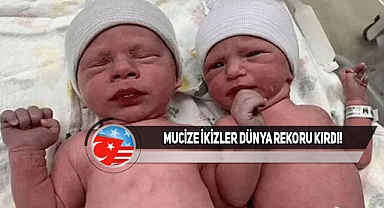 ABD'de 30 Yıldır Dondurulan İkizler Doğdu!