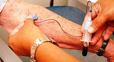  Alzheimer’ı Teşhis Eden Kan Testi Geliştirdi