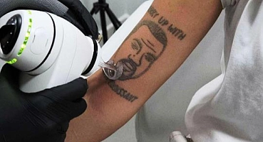 Kanye West Dövmesine Ücretsiz Sildirme