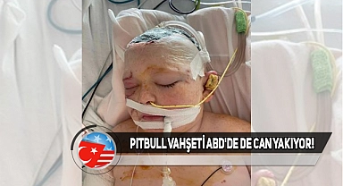 ABD'de 11 Yaşındaki Çocuğa Üç Pitbull Saldırdı