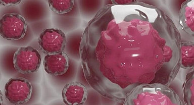 Kanser Hastası Kök Hücre Nakliyle  HIV'den Kurtuldu