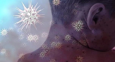 ABD'de Dini Etkinlikte Binlerce Kişiye Kızamık Salgını Uyarısı