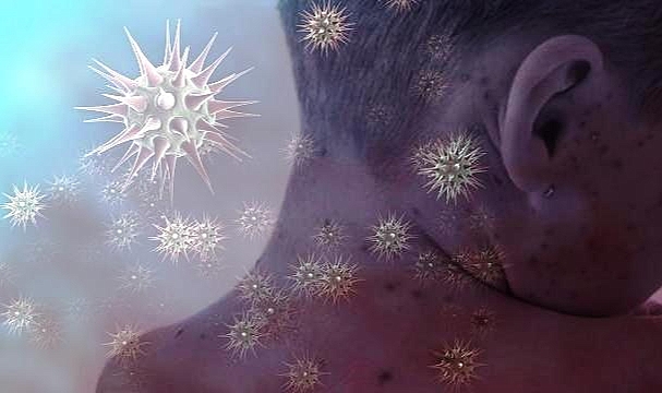 ABD'de Dini Etkinlikte Binlerce Kişiye Kızamık Salgını Uyarısı
