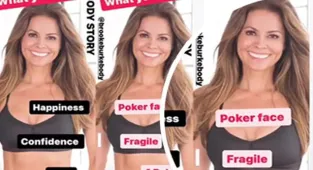 Brooke Burke suffers from THREE auto-immune diseases