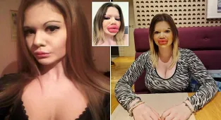 Concerned fans are worried her lips may 'burst'