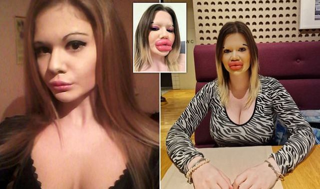 Concerned fans are worried her lips may 'burst'