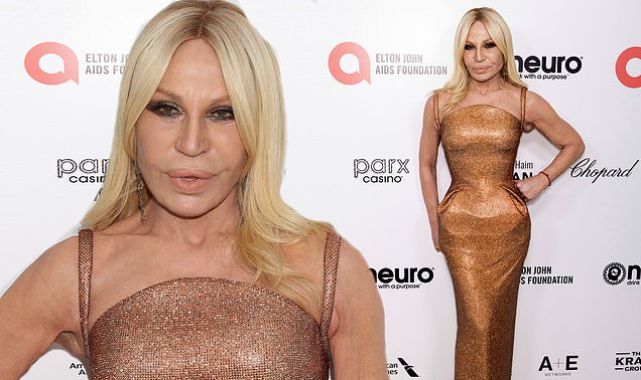 Donatella Versace flaunts smooth visage at Elton John Oscars party
