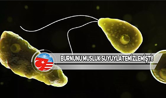 Florida'da Musluk Suyu İle Beyin Yiyen Amip Bulaştı