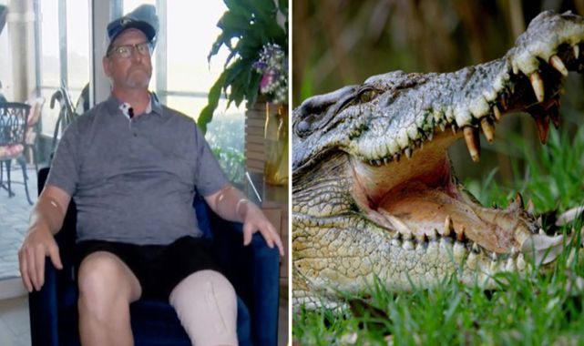 Florida man attacked by alligator after hearing noise, opening front door
