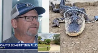 Florida man needed surgery after alligator attack on his doorstep