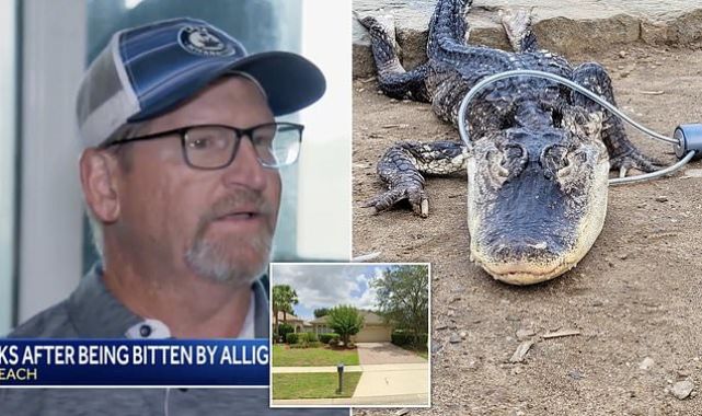 Florida man needed surgery after alligator attack on his doorstep