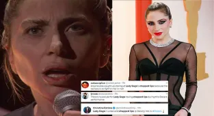 Lady Gaga's chapped lips go viral after her Oscars performance