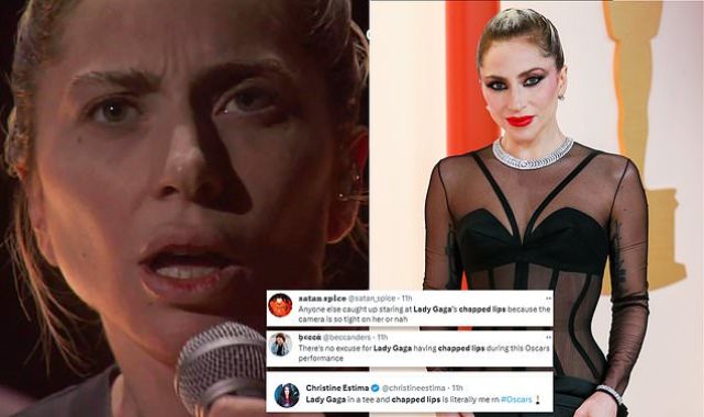 Lady Gaga's chapped lips go viral after her Oscars performance