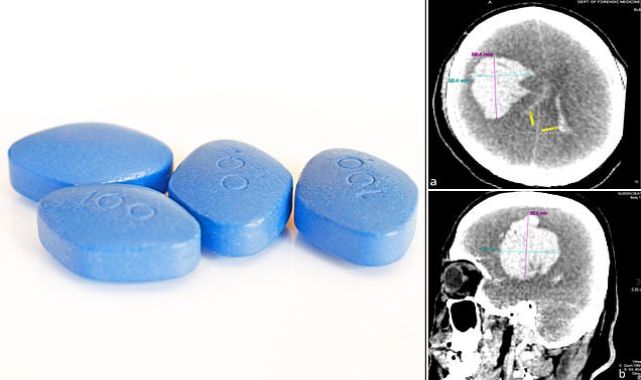 Man dies of stroke after taking Viagra on heavy night of drinking 