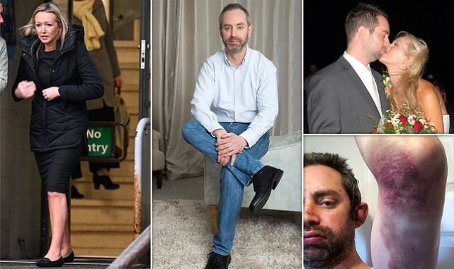 Man reveals how he wore make-up to hide bruises as abuse 'became norm'