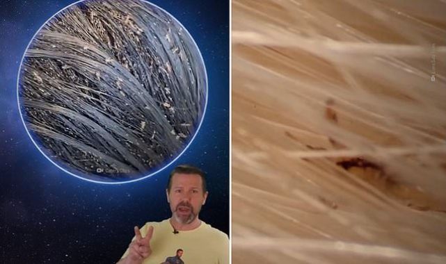 Shocking video reveals happens if you don't treat head lice