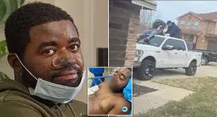 Texas man's NOSE is bitten off by neighbors' bloodthirsty pit bulls