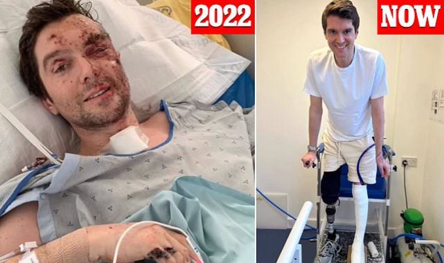 War reporter releases montage of his recovery after Russia attack