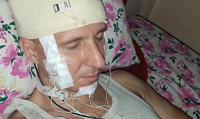 Kafasını Matkapla Deldi, Ölümden Döndü