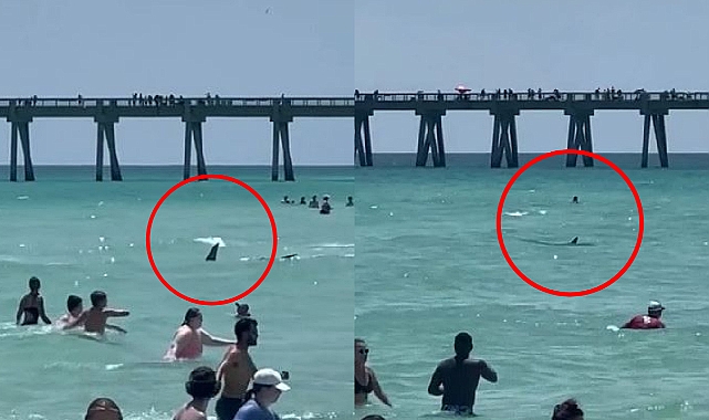 Sörf Yapan Genci Köpek Balığı Isırdı