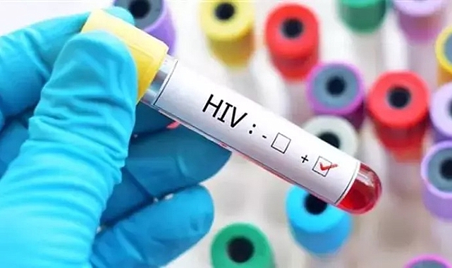 Dünya genelinde azalan AIDS, Türkiye'de 10 kat arttı