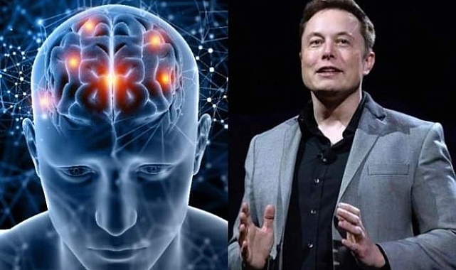 Elon Musk'ın şirketi Neuralink, ilk kablosuz beyin çipini başarıyla yerleştirdi