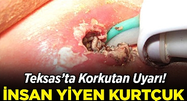 Teksas'ta Korkutan Uyarı: İnsan Yiyen Kurtçuk!