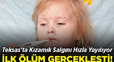 Teksas'taki Kızamık Salgını Hızla Yayılıyor: Aşısız Bir Çocuk Hayatını Kaybetti!