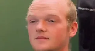 Balding teenager unrecognisable after 'amazing' transformation