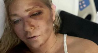 Prince Andrew's ex's brutal reaction to Epstein victim hospitalisation