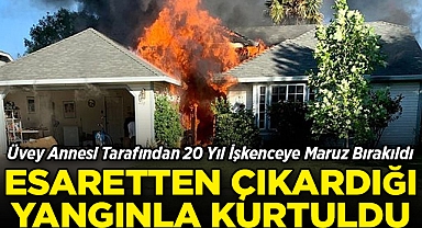 Üvey Annesi Tarafından 20 Yıl İşkenceye Maruz Bırakıldı: Esaretten, Çıkardığı Yangınla Kurtuldu!