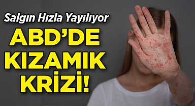 ABD'de Kızamık Krizi: Salgın Hızla Yayılıyor!